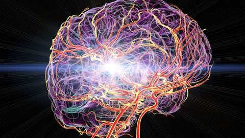 Brain stroke, conceptual illustration