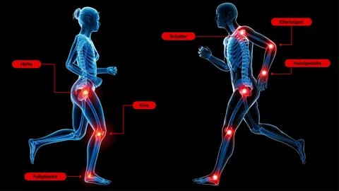 Entzündete Gelenke im Körper des Menschen